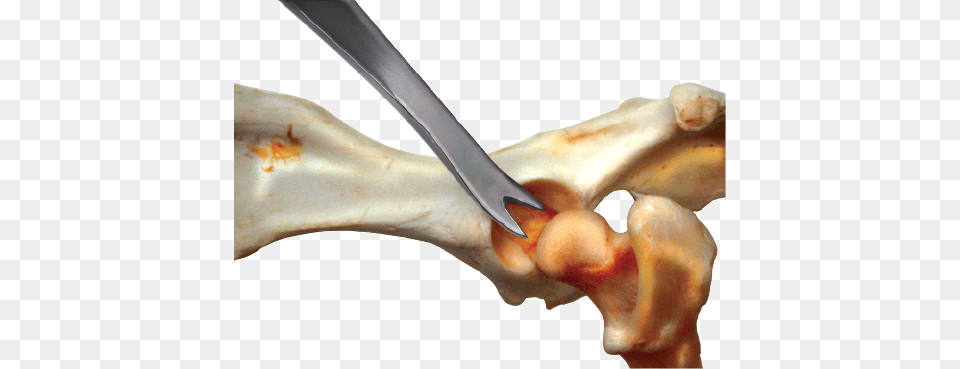 Femoral Head Diarticulator Large Femoral Head, Cutlery, Smoke Pipe, Spoon Png