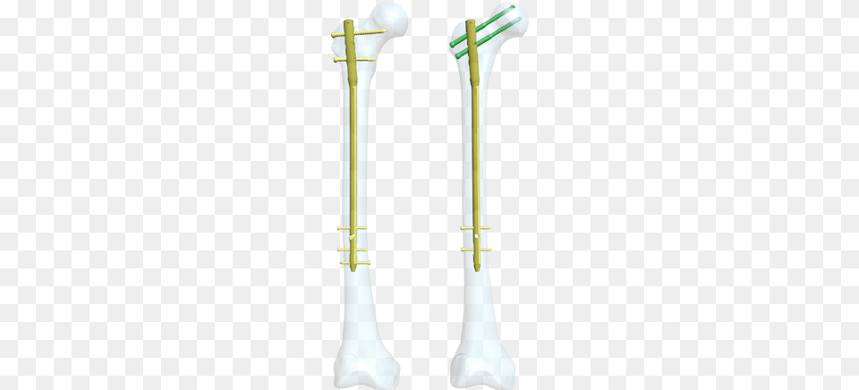 Femur Reconstruction Im Nail System Intramedullary Rod, Musical Instrument, Smoke Pipe Png Image