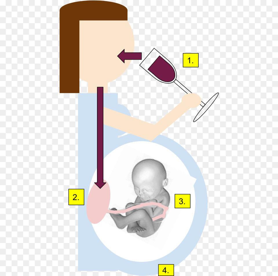 Fetal Alcohol Syndrome Clipart, Cutlery, Spoon, Baby, Person Free Png