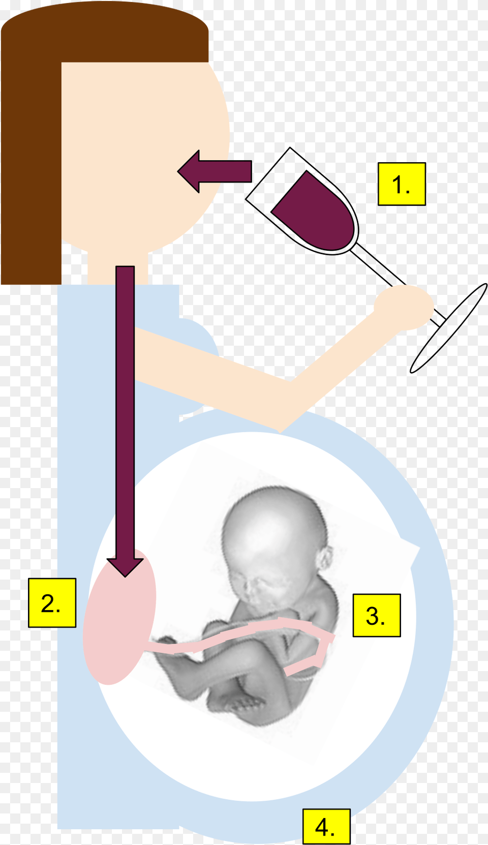 Fetal Alcohol Syndrome Gif, Cutlery, Spoon, Baby, Person Free Png Download