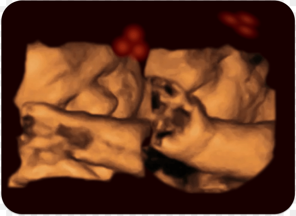 Fetus, Finger, Body Part, Person, Hand Free Transparent Png