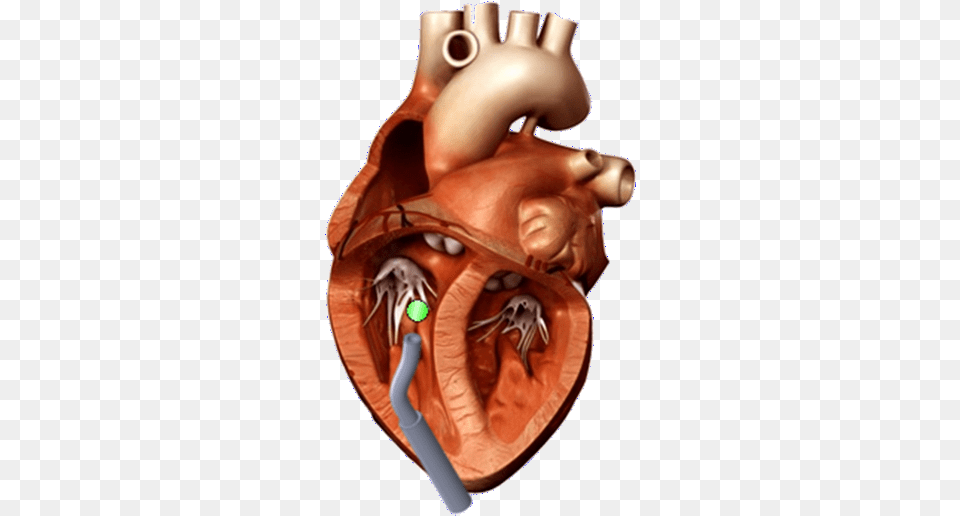 Fileheartpng Paul Thienphrapa 3d Heart Model, Baby, Person Png Image