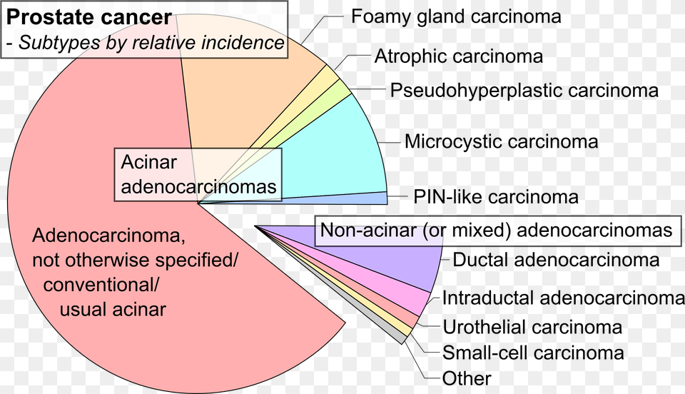 Fileprostate Cancer Typespng Wikipedia Prostate Cancer Types, Disk, Chart Png