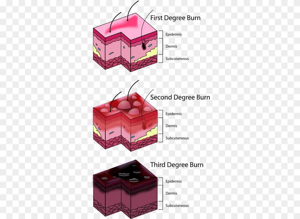 First Degree Rope Burn, Box, Dynamite, Weapon Png