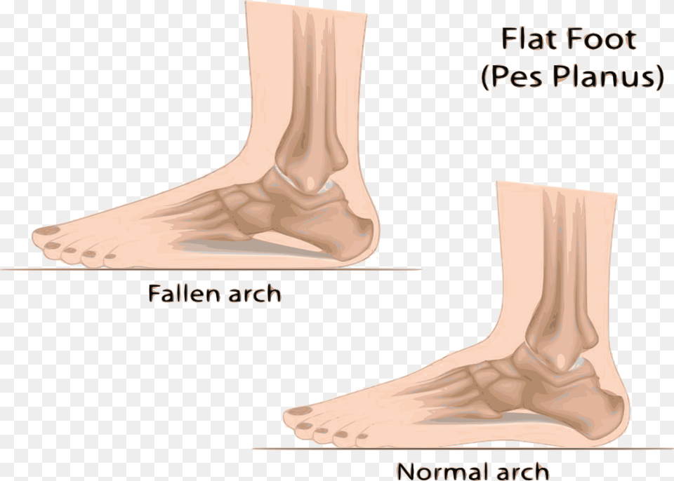 Flat Feet, Ankle, Body Part, Person, Smoke Pipe Png