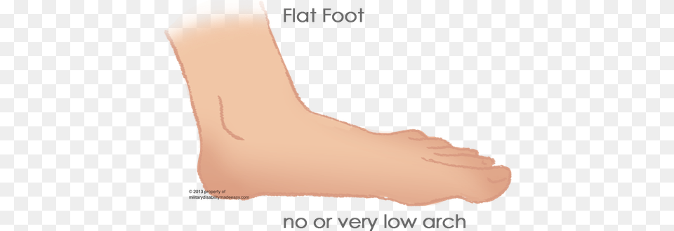 Flat Foot 1 Flat Foot Disease, Ankle, Body Part, Person, Smoke Pipe Free Transparent Png