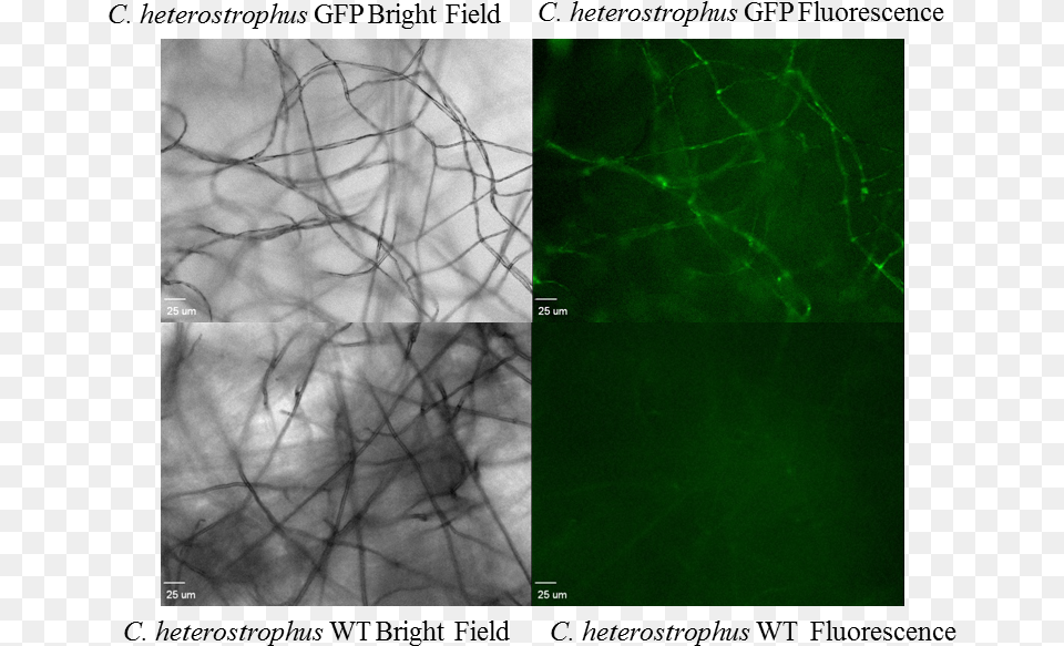 Fluorescence Microscopy Showed Evidence Of Gfp Expression Photo Caption, Art, Collage, Accessories, Baby Png Image