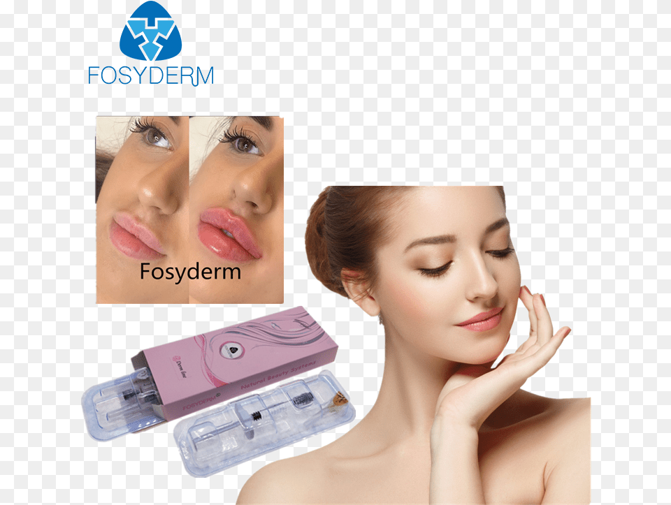 Fosyderm 2ml Derm Lines Injectable Dermal Filler For Lips Facial Cantik, Adult, Face, Female, Head Free Png