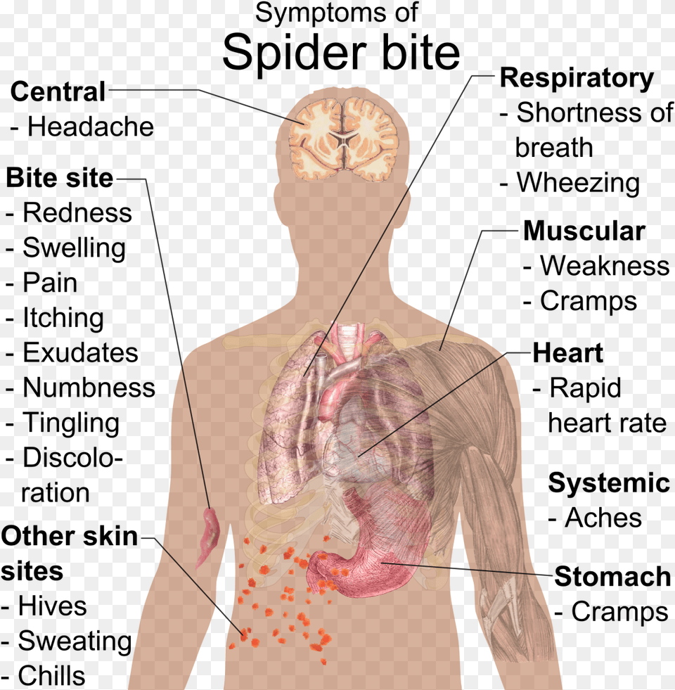 From The Giant Hairy Tarantula To The Extraordinarily Spider Bite On The Lip, Adult, Female, Person, Woman Free Transparent Png