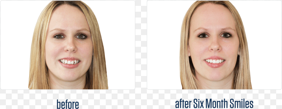 Gallery 12 Blond, Adult, Face, Female, Head Free Transparent Png
