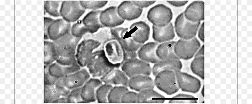 Gametocyte In Peripheral Blood Smear From The Hoary Hoary Fox, Face, Head, Person Free Png