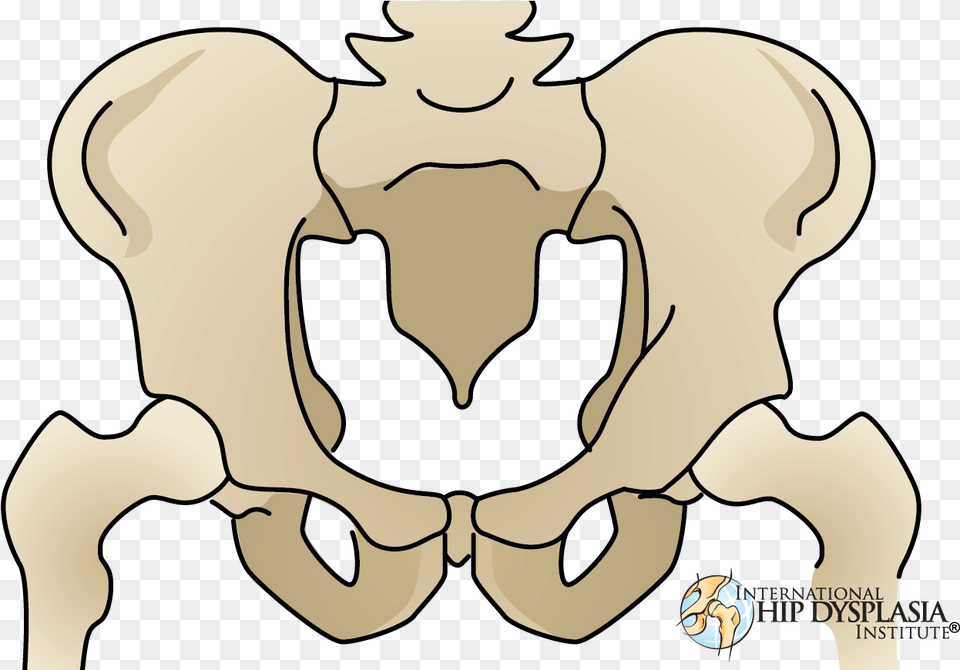 Ganz Osteotomy, Baby, Person, Face, Head Png Image