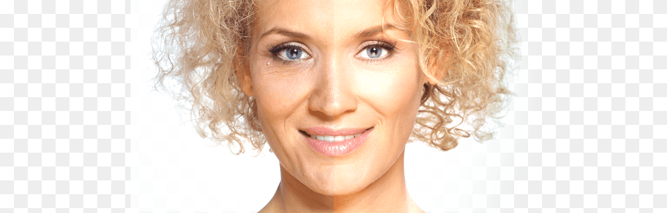 Get Rid Of Wrinkles Brazilian Plastic Surgery, Person, Face, Smile, Happy Free Png