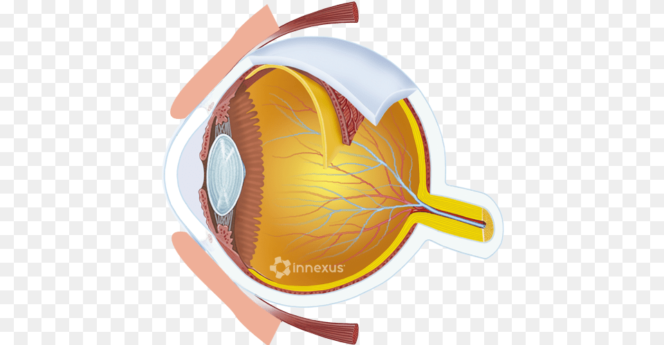 Glaucoma, Cup, Food, Meal, Dish Free Transparent Png