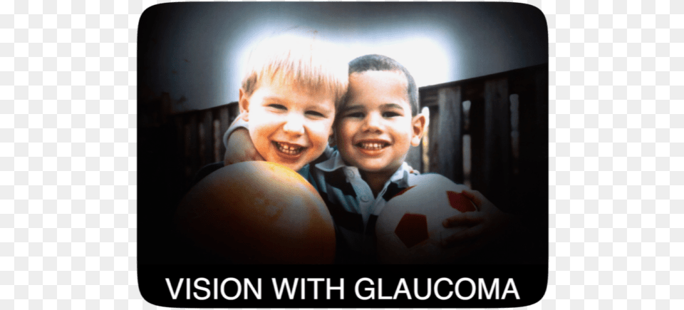 Glaucoma Can Silently Rob You Of Sight Do You See If You Have Glaucoma, Sport, Soccer, Portrait, Photography Png Image