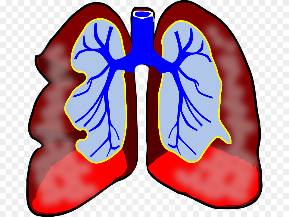 Global Asthma Copd Market To See Major Growth, Ct Scan, Flower, Iris, Plant Png