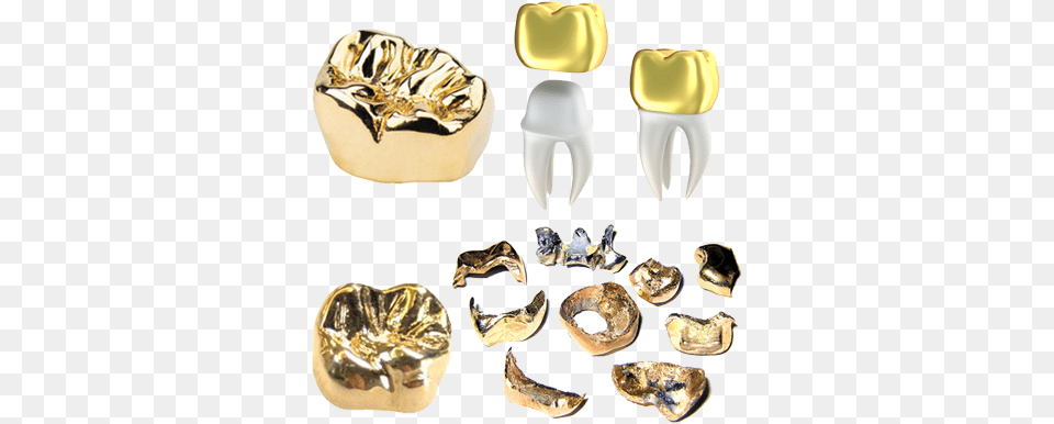 Gold Teeth Caps We Buy Salem Gold Crown Tooth, Electronics, Hardware, Accessories, Gemstone Free Transparent Png