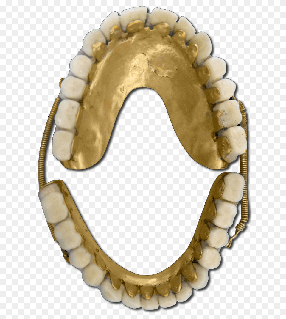 Gold Teeth Jaw, Body Part, Mouth, Person, Head Free Png Download