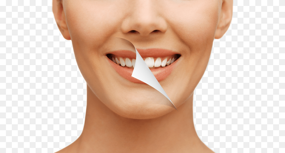 Gold Tooth Price In Cape Town, Body Part, Mouth, Person, Teeth Free Png Download