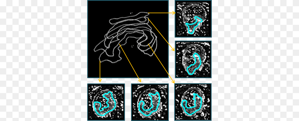 Graphic Design, Nature, Outdoors, Ct Scan, Blackboard Free Png