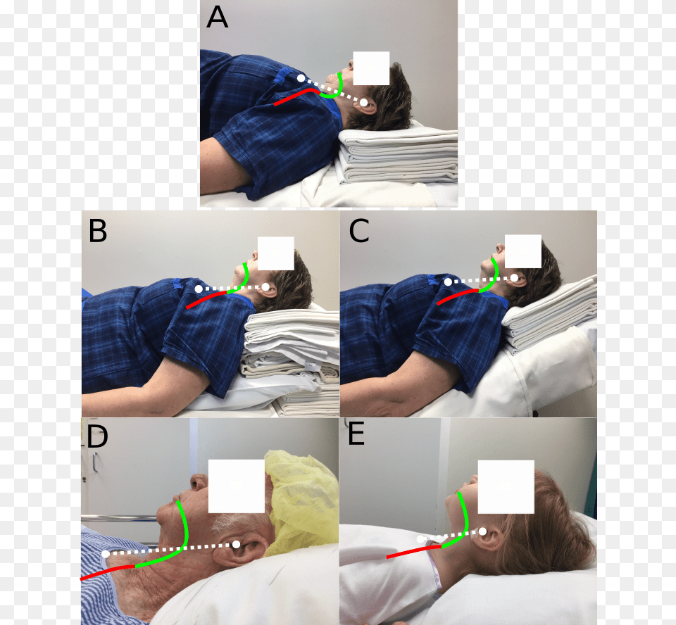Greenland On Positioning Bedroom, Person, Patient, Adult, Baby Png