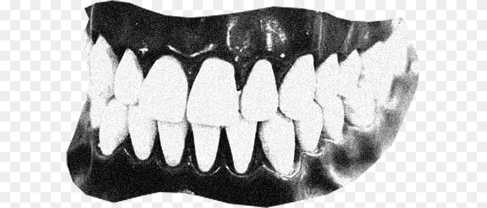 Gums, Body Part, Mouth, Person, Teeth Png Image