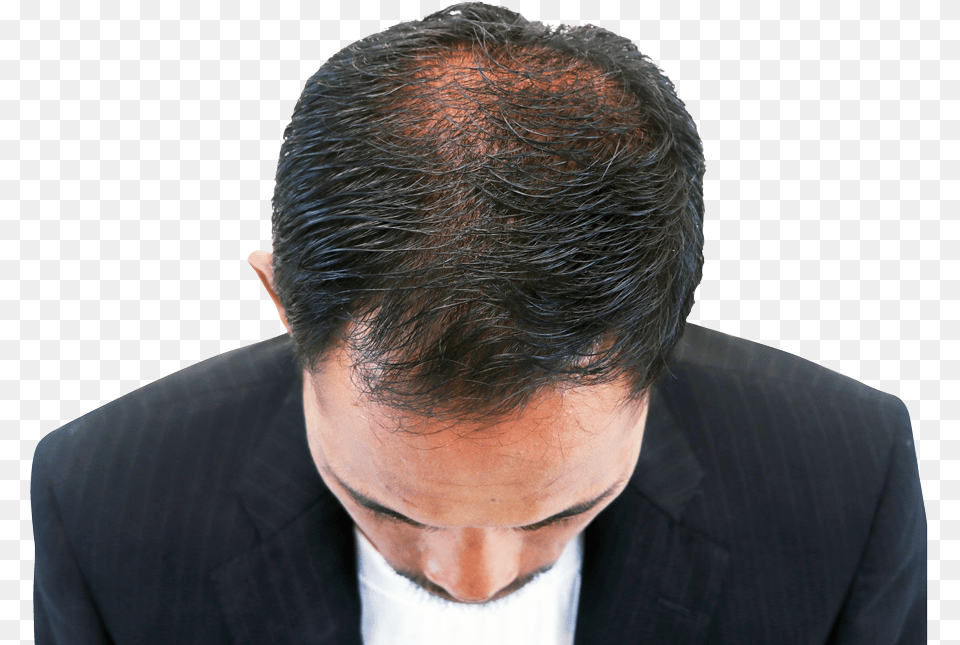 Hair Growth Dr Batra Review, Portrait, Photography, Person, Head Free Png