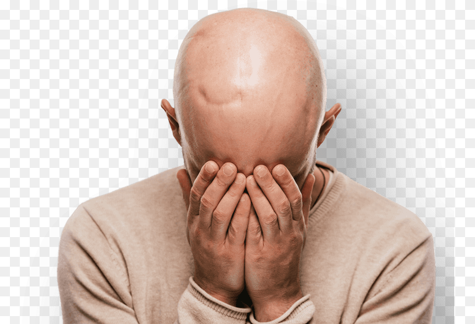 Hair Loss, Face, Head, Person, Adult Free Transparent Png