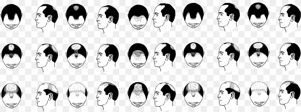 Hair Loss Pattern, Book, Comics, Publication, Person Free Png Download