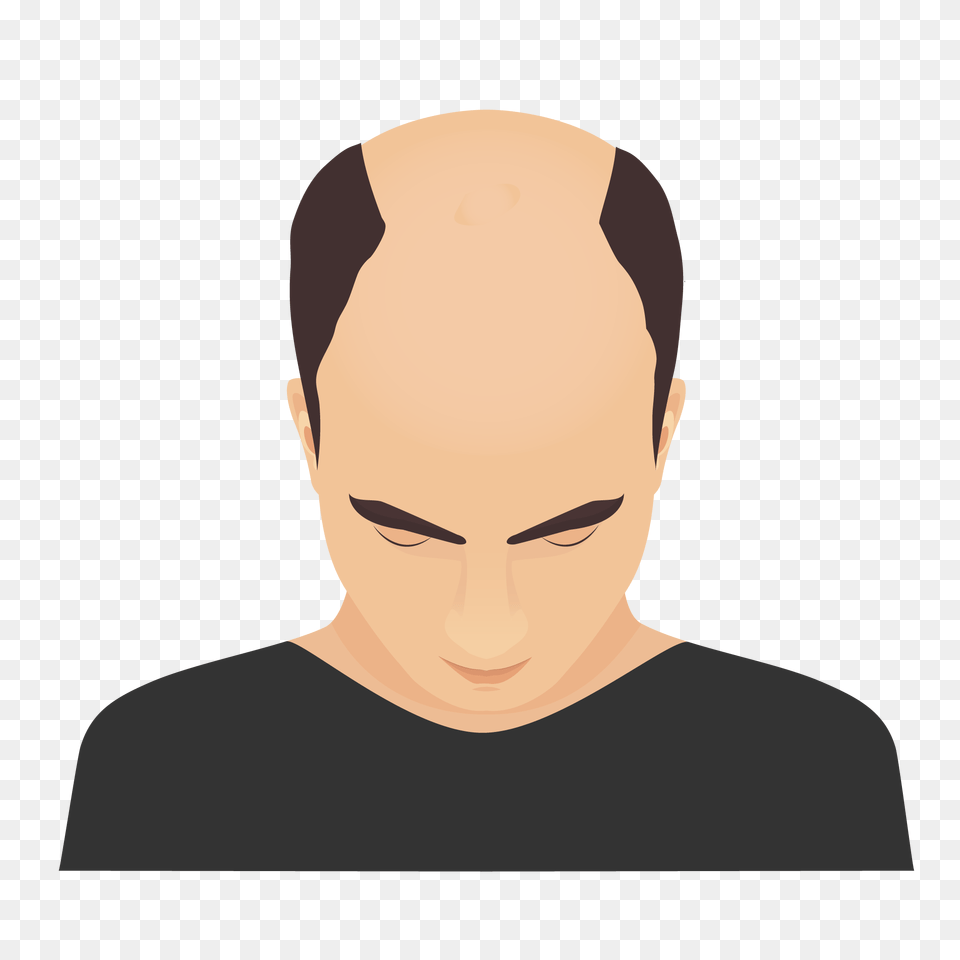 Hair Loss Treatment For Men Hair Transplant Hair, Face, Head, Person, Photography Free Png Download