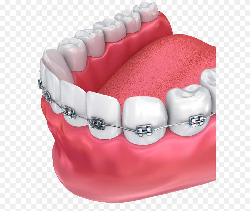 Haltom Orthodontics Tooth Orthodontics, Birthday Cake, Person, Mouth, Food Png