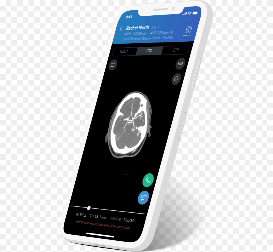 Hd Viz Lvo White Iphone X Smartphone, Ct Scan, Electronics, Mobile Phone, Phone Free Png Download