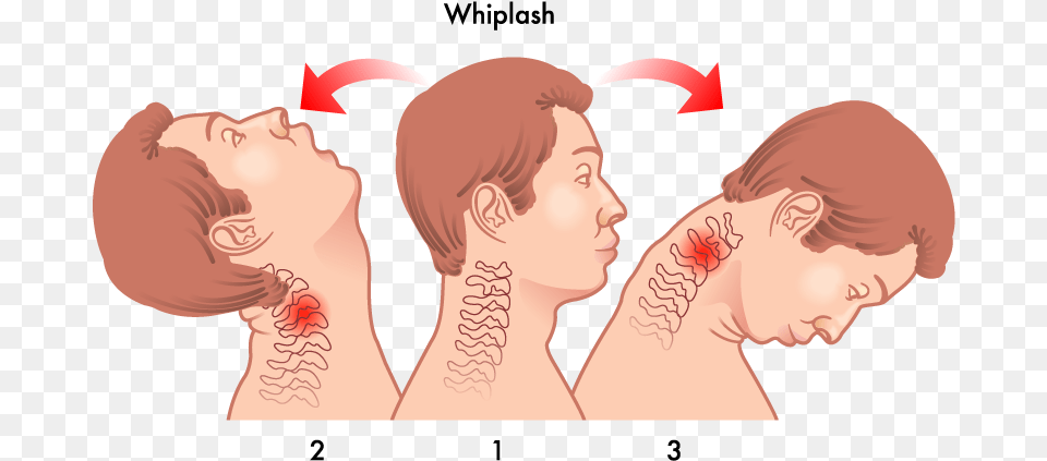 Head Neck Whiplash Whiplash Injury, Body Part, Face, Person, Adult Png Image