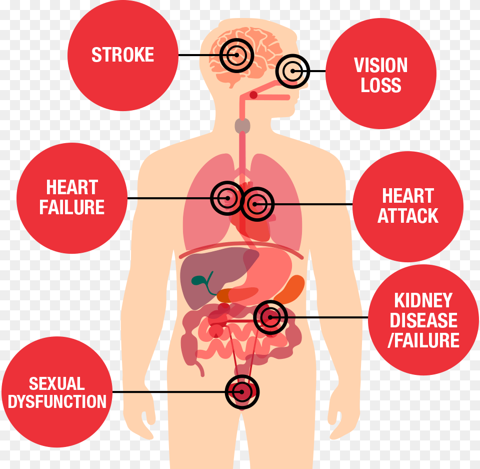 Health Threats Diagram Effects Of High Blood Pressure, Adult, Male, Man, Person Png