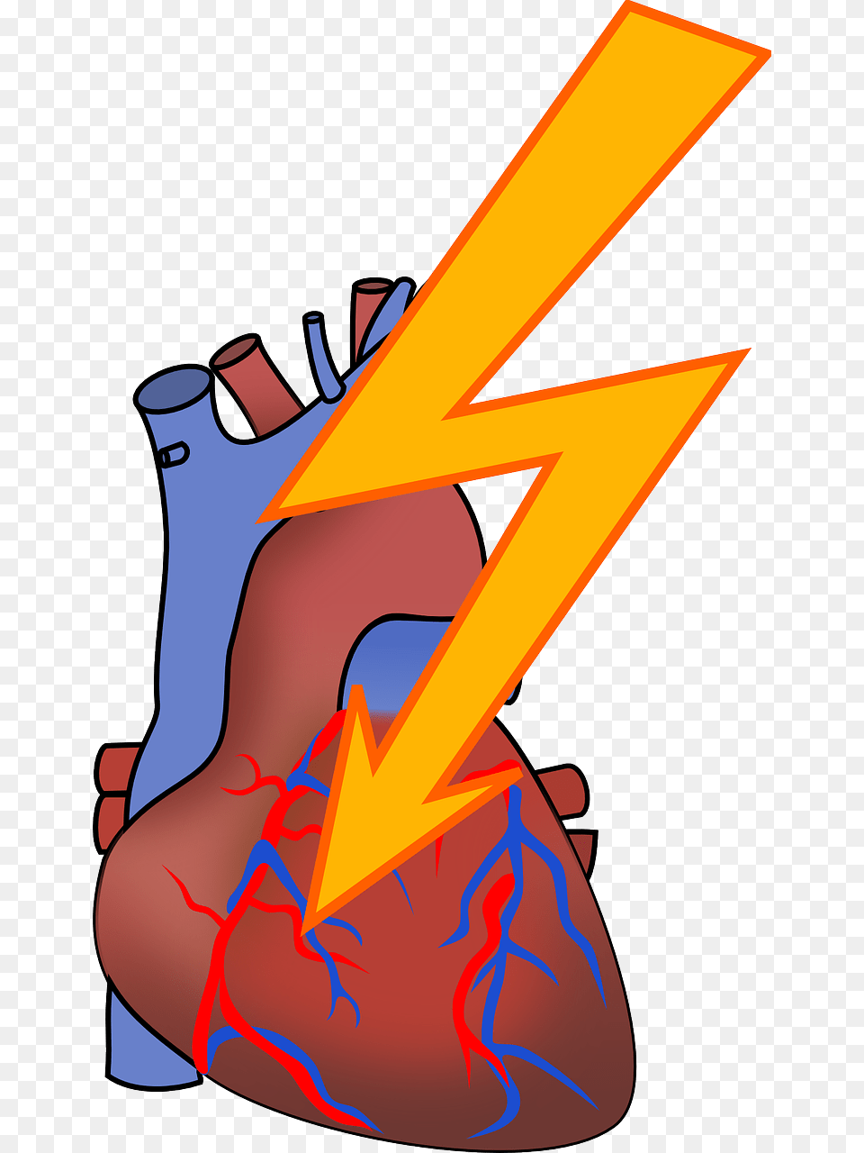 Heart Attack Reason In Urdu Png Image