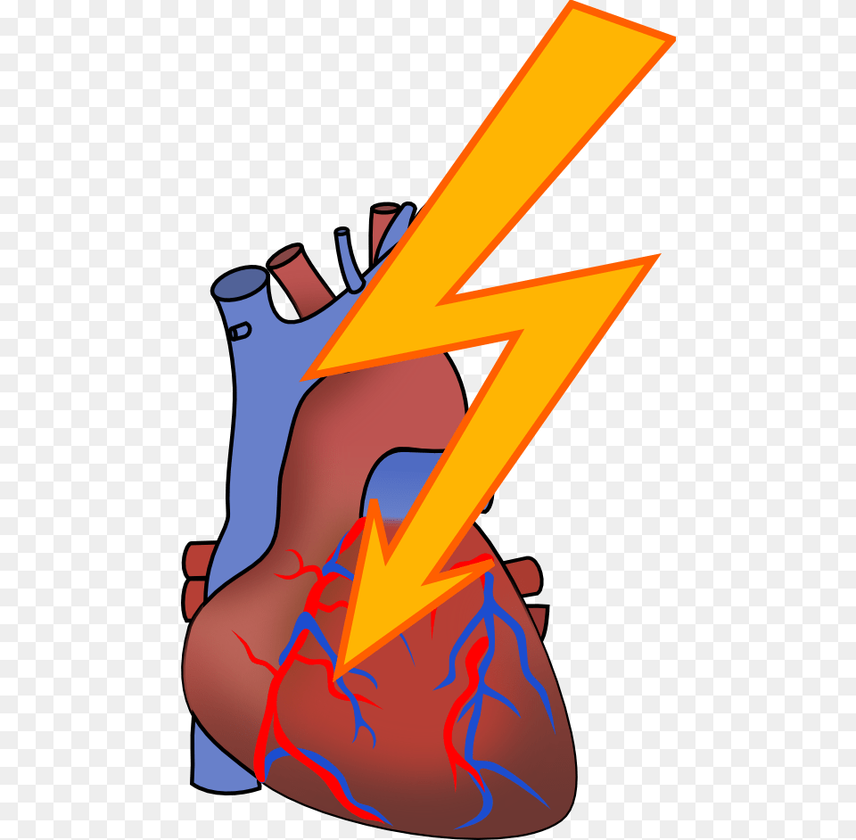 Heart Heart Attack Clipart, Dynamite, Weapon Free Transparent Png