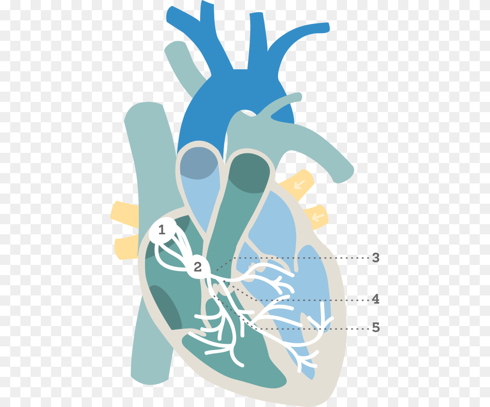 Heart Nodes Electrical Conduction Pathway Blank, Baby, Person, Face, Head Free Png Download