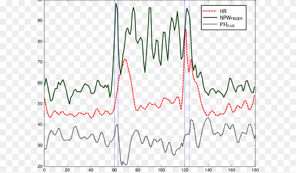 Heart Pulse, Chart, Plot, Electronics Free Png