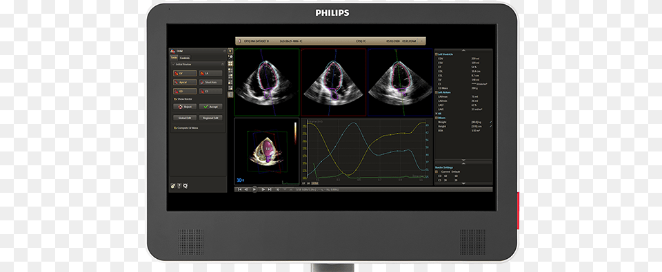 Heartmodel 3d Echocardiography Philips Healthcare Philips Heart Model, Electronics, Screen, Computer Hardware, Hardware Png Image