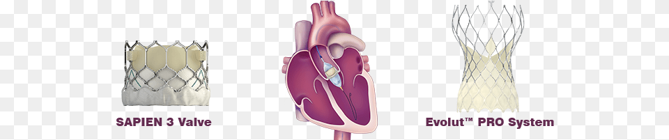 Heartpages Tavr Valvesb Percutaneous Aortic Valve Replacement, Accessories, Bag, Handbag, Clothing Png