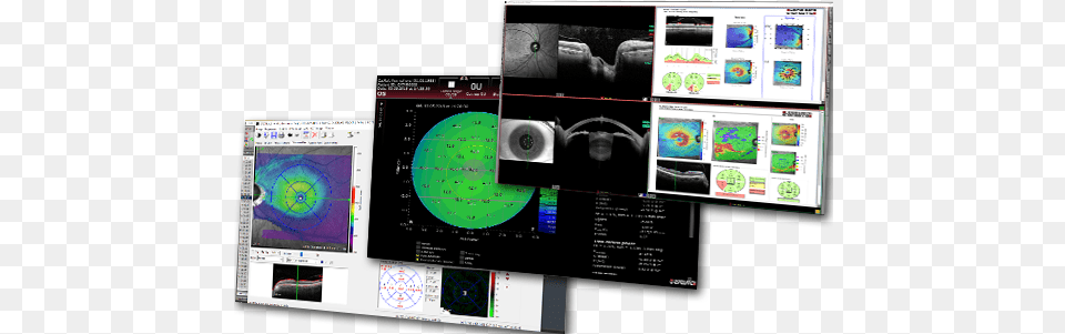 Heidelberg Eye Explorer Heyex 2 Vs 1, Computer Hardware, Electronics, Hardware, Monitor Free Transparent Png