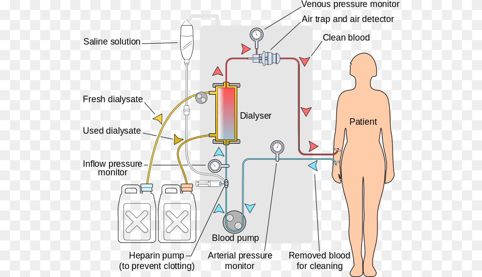 Hemodialysis Acts As An Artificial Kidney To Filter Renal Dialysis, Chart, Plot, Adult, Female Free Transparent Png