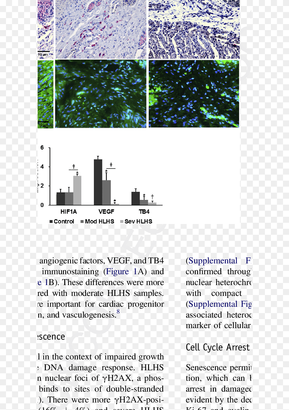 Hif 1a And Downstream Growth Factor Expression In Fetal Architecture, Page, Text, Plant, Vegetation Png