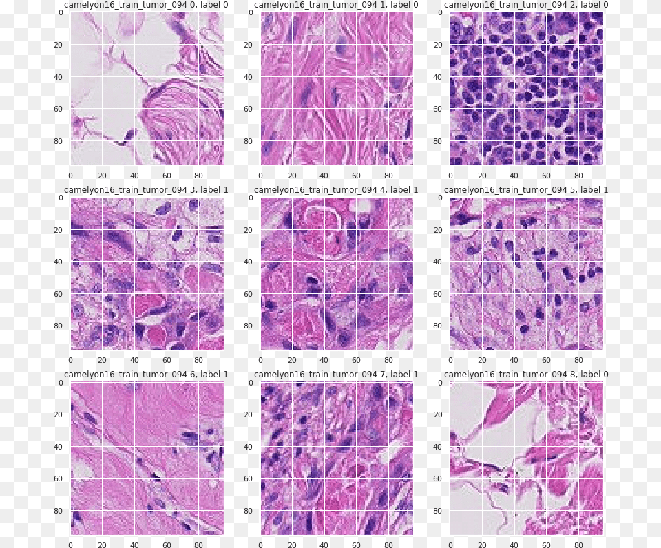 Histopathologic Cancer Detection, Purple, Art, Paper Free Transparent Png