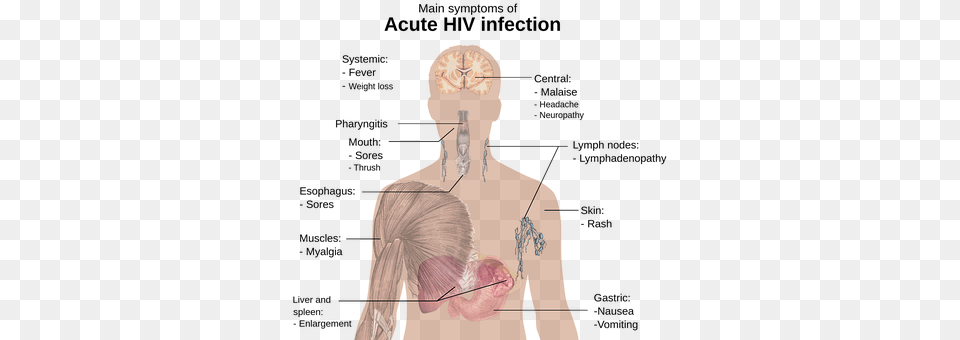 Hiv Adult, Male, Man, Person Free Png