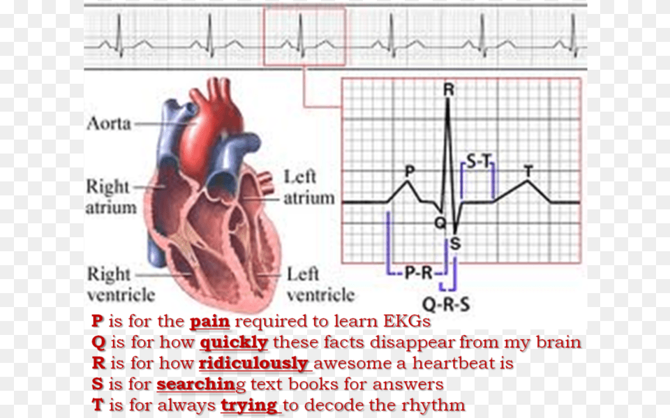 Holter Monitor Fenomeno Electrico Del Corazon, Chart, Plot, Diagram Free Png Download
