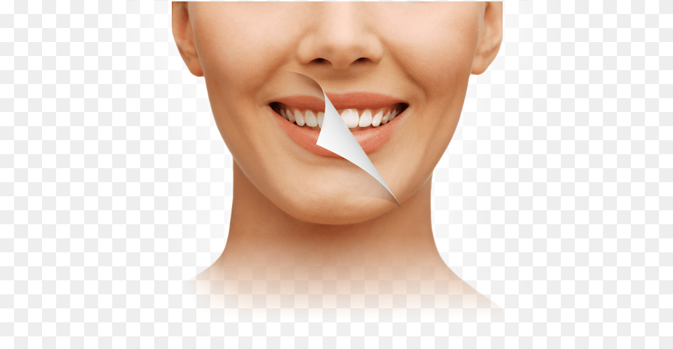 Home Bleaching, Body Part, Mouth, Person, Teeth Free Png Download