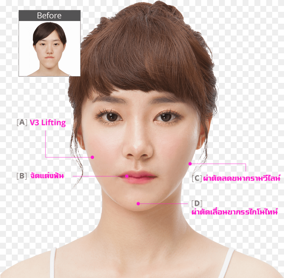 Hospital Healthy Happy Face Plastic Surgery, Adult, Person, Neck, Head Free Png