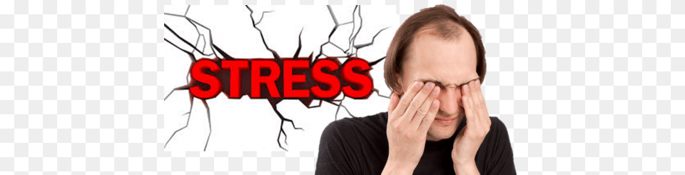 How Anxiety And Stress Can Cause Hair Loss Stress Can Cause Hair Loss, Adult, Male, Man, Person Free Png