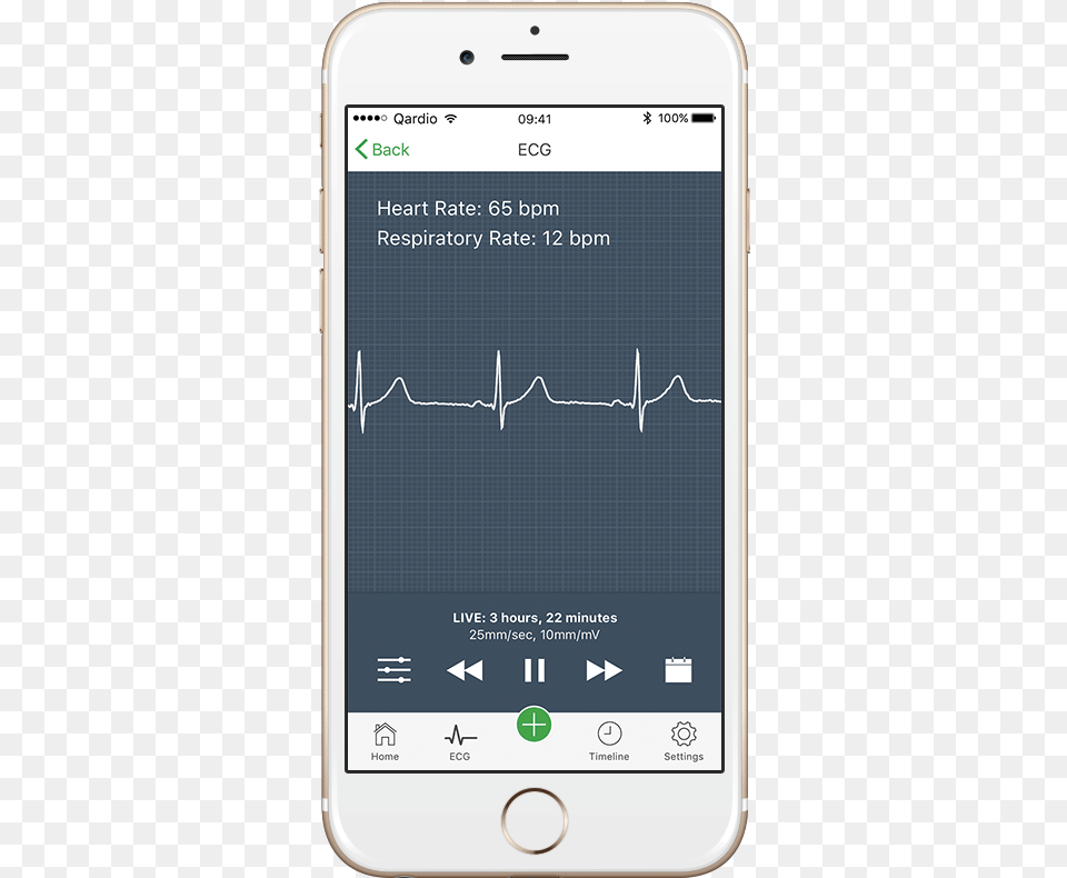 How To Read An Electrocardiogram Atrial Fibrillation Afib Monitor, Electronics, Mobile Phone, Phone Free Transparent Png